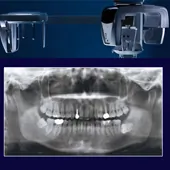 morita-dentalni-rendgen-centar-snimanje-zuba